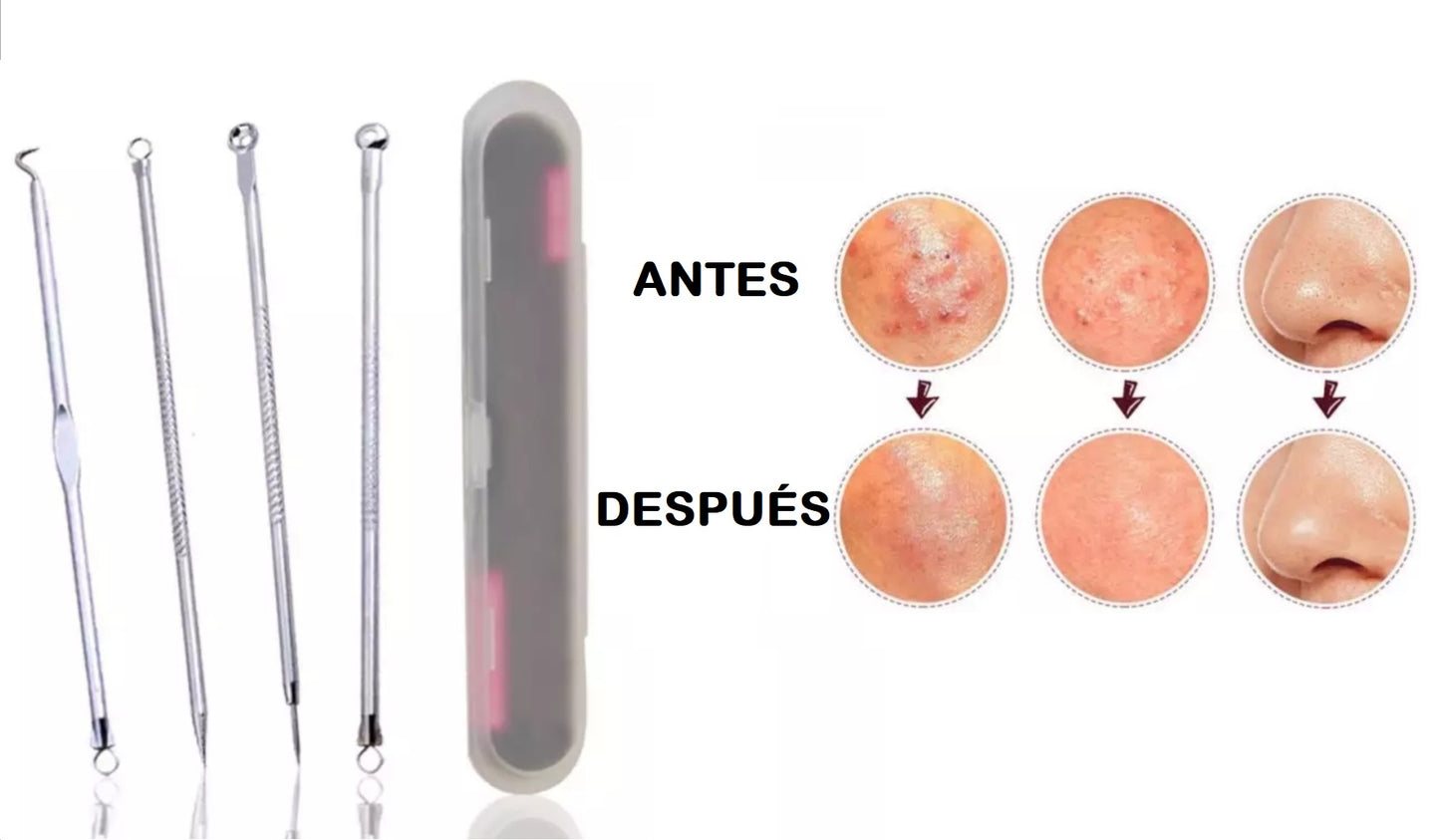 EXTRACTOR DE ESPINILLAS  Y PUNTOS